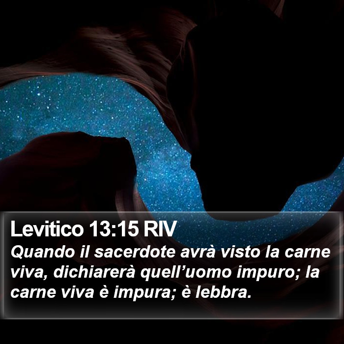 Levitico 13:15 RIV Bible Study